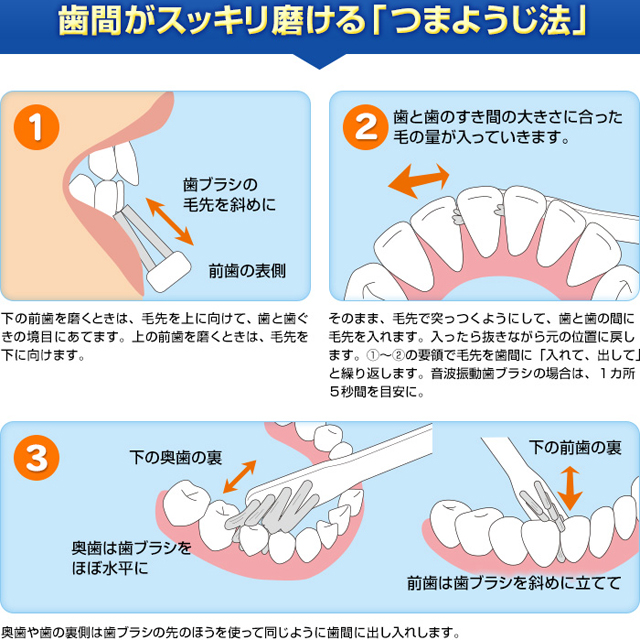 歯周病の歯